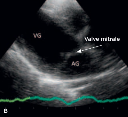 figure 1b